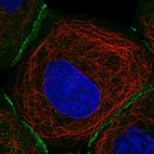 Immunofluorescent staining of human cell line A-431 shows localization to plasma membrane & cell junctions.