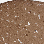 Anti-LANCL1 Antibody