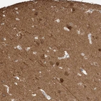 Anti-LANCL1 Antibody