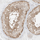Immunohistochemical staining of human testis shows moderate membranous positivity in cells in seminiferous ducts.