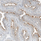 Immunohistochemical staining of human fallopian tube shows moderate positivity in cilia in glandular cells.