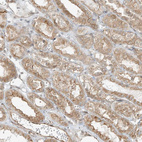 Immunohistochemical staining of human kidney shows weak membranous positivity in cells in tubules.