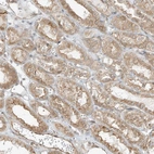 Immunohistochemical staining of human kidney shows weak membranous positivity in cells in tubules.
