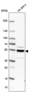 Western blot analysis in human cell line SK-BR-3.