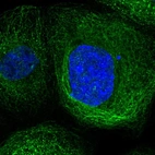 Immunofluorescent staining of human cell line A-431 shows localization to microtubules.