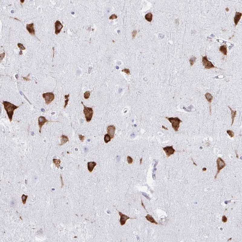 Anti-PRKRA Antibody