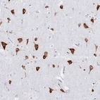 Anti-PRKRA Antibody