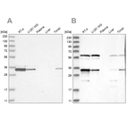 Western blot analysis using Anti-PRKRA antibody HPA034996 (A) shows similar pattern to independent antibody HPA034997 (B).