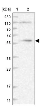Lane 1: Marker [kDa] 230, 130, 95, 72, 56, 36, 28, 17, 11_br/_Lane 2: Human cell line RT-4