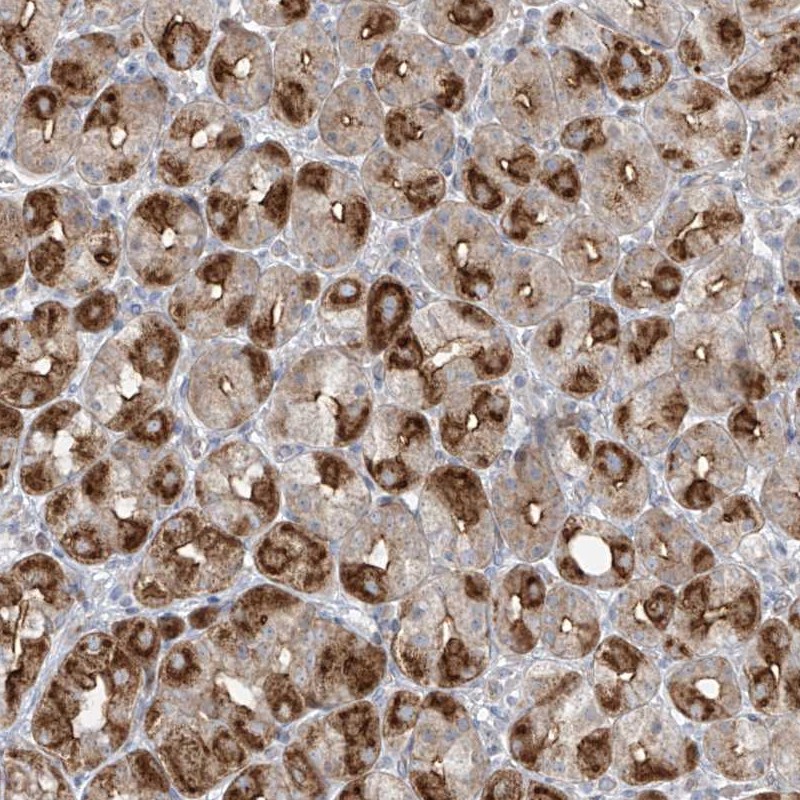 Anti-ABTB1 Antibody