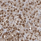 Anti-ABTB1 Antibody