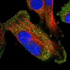 Immunofluorescent staining of human cell line U-251 MG shows localization to cytosol.