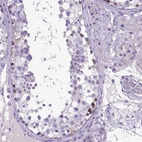 Immunohistochemical staining of human testis shows high expression.