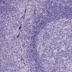 Anti-PLK5 Antibody