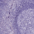 Immunohistochemical staining of human tonsil shows low expression as expected.