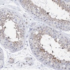 Anti-PLK4 Antibody