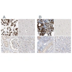 Immunohistochemical staining of human bone marrow, cerebral cortex, kidney and liver using Anti-GCA antibody HPA035034 (A) shows similar protein distribution across tissues to independent antibody HPA035033 (B).