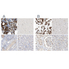 Immunohistochemical staining of human bone marrow, cerebral cortex, kidney and liver using Anti-GCA antibody HPA035033 (A) shows similar protein distribution across tissues to independent antibody HPA035034 (B).