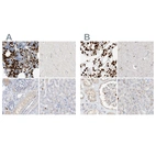 Immunohistochemical staining of human bone marrow, cerebral cortex, kidney and liver using Anti-GCA antibody HPA035033 (A) shows similar protein distribution across tissues to independent antibody HPA035034 (B).