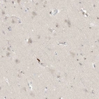 Immunohistochemical staining of human cerebral cortex shows low expression as expected.