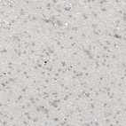 Immunohistochemical staining of human cerebral cortex shows low expression as expected.