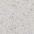 Immunohistochemical staining of human cerebral cortex shows low expression as expected.