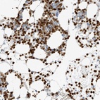 Immunohistochemical staining of human bone marrow shows high expression.