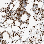 Immunohistochemical staining of human bone marrow shows high expression.