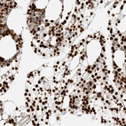 Immunohistochemical staining of human bone marrow shows high expression.