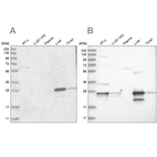 Western blot analysis using Anti-GCA antibody HPA035033 (A) shows similar pattern to independent antibody HPA035034 (B).