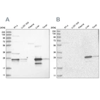 Western blot analysis using Anti-GCA antibody HPA035034 (A) shows similar pattern to independent antibody HPA035033 (B).
