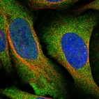 Immunofluorescent staining of human cell line U-2 OS shows localization to cytosol.