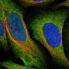Immunofluorescent staining of human cell line U-2 OS shows localization to cytosol.
