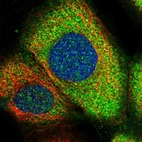 Immunofluorescent staining of human cell line A-431 shows localization to cytosol.