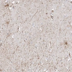 Anti-ETAA1 Antibody