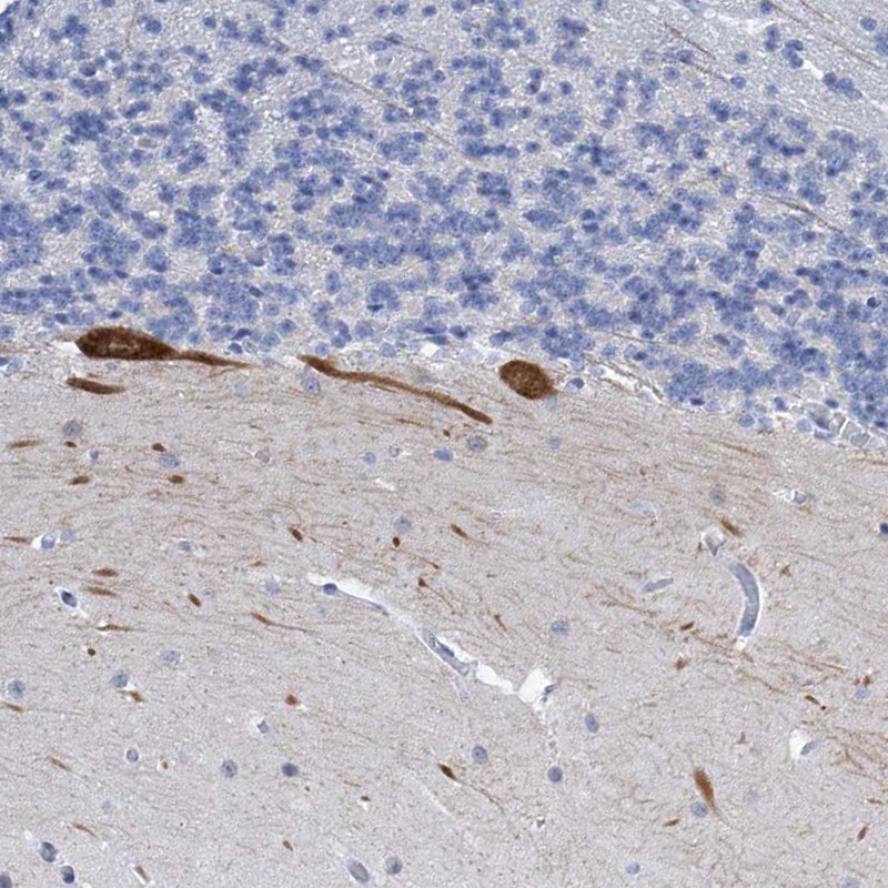 Anti-PRSS12 Antibody