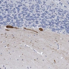Anti-PRSS12 Antibody