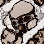 Anti-HIKESHI Antibody