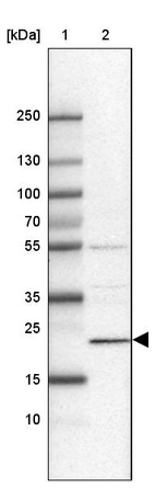 Lane 1: Marker [kDa] 250, 130, 100, 70, 55, 35, 25, 15, 10_br/_Lane 2: Human cell line CACO-2
