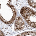 Anti-GPR152 Antibody