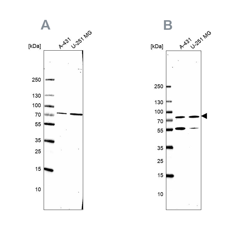 Anti-ATP6V1A Antibody