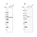 Anti-ATP6V1A Antibody