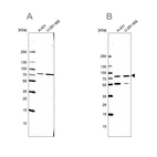 Anti-ATP6V1A Antibody