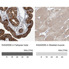 Anti-KIAA0556 Antibody