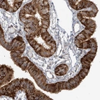Immunohistochemical staining of human fallopian tube shows high expression.