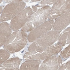 Immunohistochemical staining of human skeletal muscle shows low expression as expected.