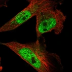 Immunofluorescent staining of human cell line U-251 MG shows localization to nuclear speckles.