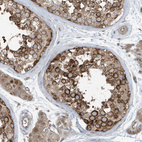Immunohistochemical staining of human testis shows strong cytoplasmic positivity in cells in seminiferous ducts.
