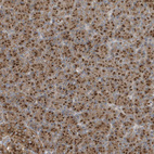 Immunohistochemical staining of human pancreas shows strong cytoplasmic granular positivity in exocrine glandular cells.
