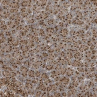 Immunohistochemical staining of human pancreas shows strong cytoplasmic granular positivity in exocrine glandular cells.